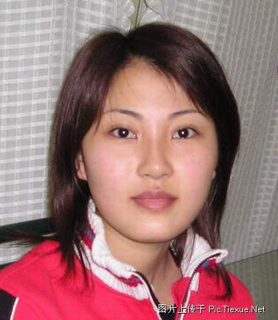 整容前后